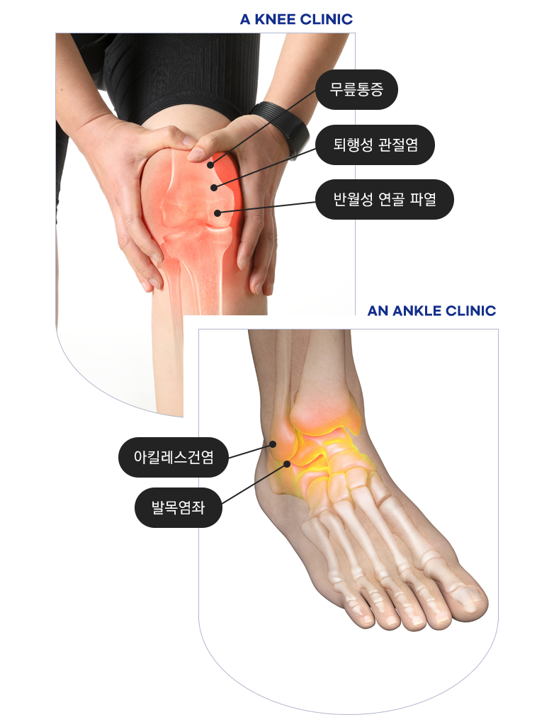 무릎,발목 클리닉